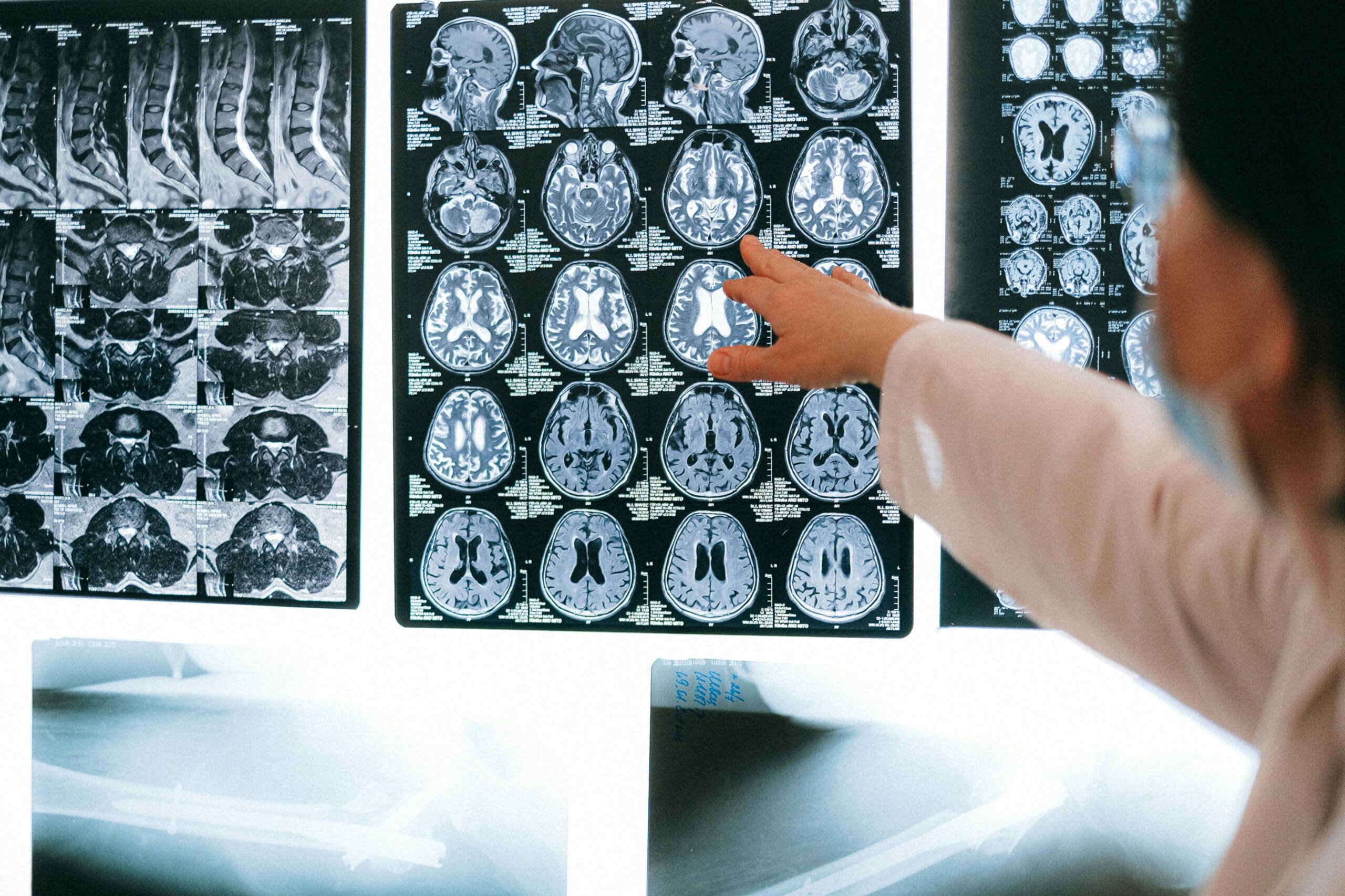‘Brain-Eating Amoeba’ Kills 19 In Kerala. How It Spreads, How To Stay Safe
